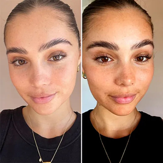 Transformation you can see with Sorelle